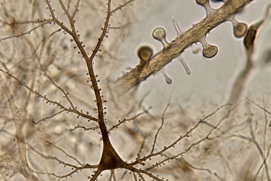 Psilocybine : le cerveau recâble ses connexions, mais pas toutes de la même façon