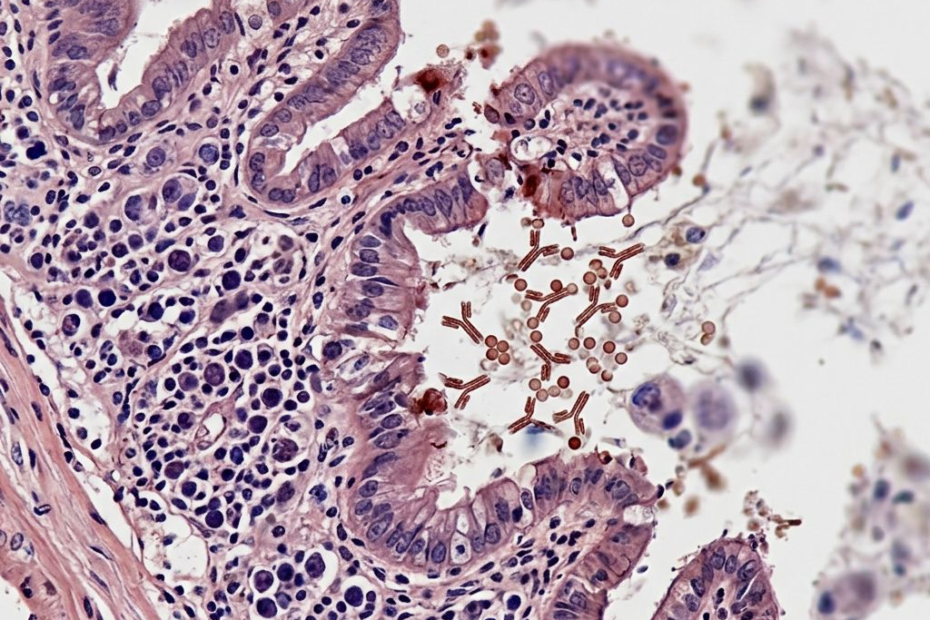 Quand le corps désactive son propre frein anti-inflammatoire