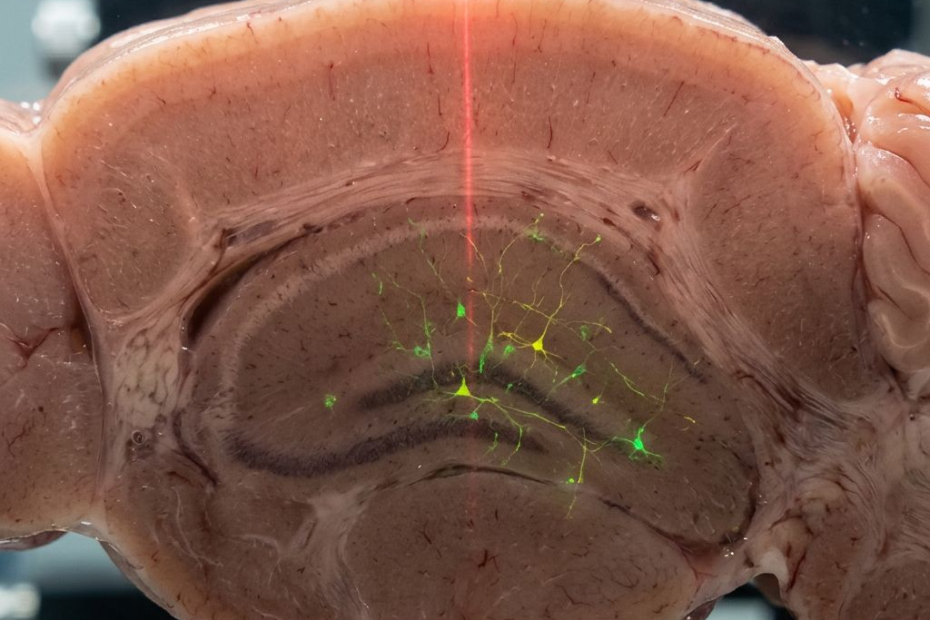 Voir plus profondément dans le cerveau, sans toucher à sa surface